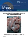 Cover image of Acute Prolonged Hamstrings Vibration Reduces Limb Stiffness Following Anterior Cruciate Ligament Reconstruction During a Single-Limb Drop-Jump Task